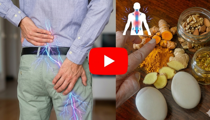 Sciatic nerve pain video
